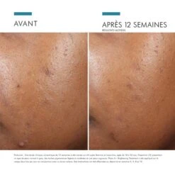 Skinceuticals Phyto A+ Brightening Treatment - Contenance : 30 Ml -Jequiti Shop 736b696e636575746963616c732d706879746f2d612d627269676874656e696e672d74726561746d656e742d3581d7a012