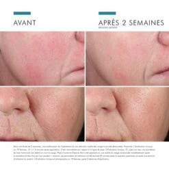 SkinCeuticals Phyto Corrective Essence Mist - Contenance : 50 Ml -Jequiti Shop 736b696e636575746963616c732d706879746f2d636f72726563746976652d657373656e63652d6d6973742d340d203d8b